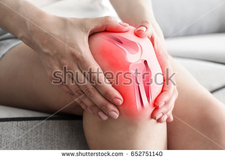 stock-photo-health-care-concept-woman-suffering-from-pain-in-knee-closeup-652751140.jpg