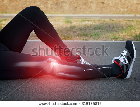 stock-photo-runner-knee-injury-and-pain-with-leg-bones-visible-318125816.jpg