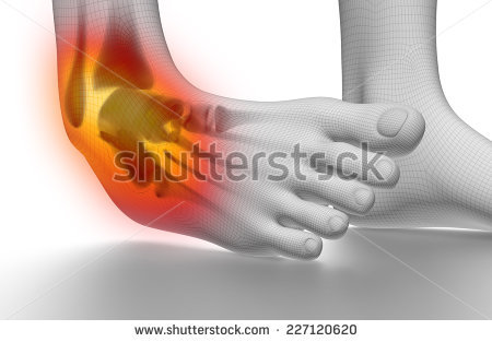 stock-photo-sprained-ankle-on-white-227120620.jpg