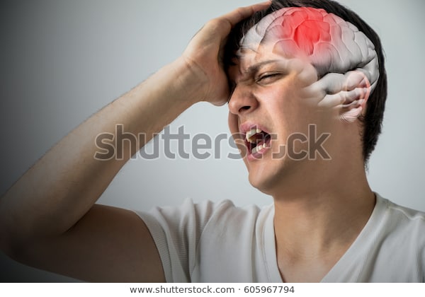 brain-stroke-concept-headache-cerebral-600w-605967794.jpg