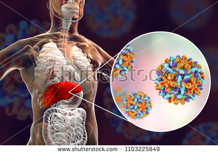 stock-photo-liver-with-hepatitis-b-infection-highlighted-inside-human-body-and-close-up-view-of-hepatitis-b-1103225849.jpg