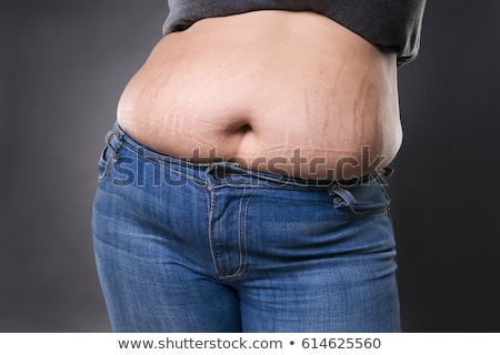 woman-fat-abdomen-blue-jeans-450w-614625560.jpg