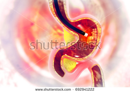 stock-photo-endoscopy-d-illustration-692941222.jpg