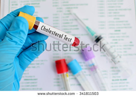 stock-photo-blood-sample-for-cholesterol-testing-341811503.jpg