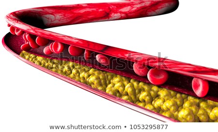cholesterol-formation-fat-artery-vein-450w-1053295877.jpg