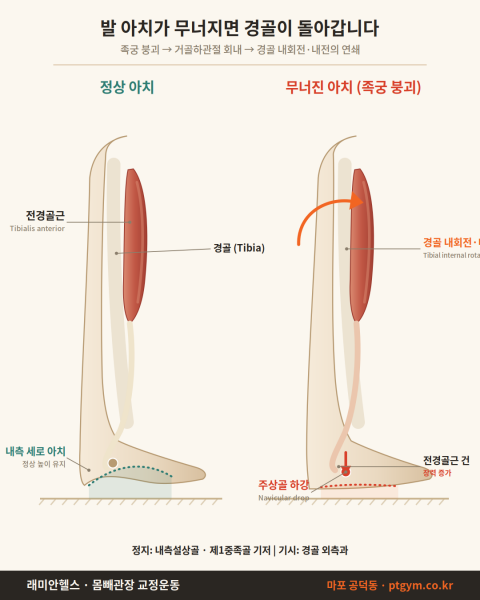 아현 PT 헬스 | 발 아치가 무너지면 왜 경골이 안쪽으로 돌아갈까 - 1 - 20260728003251