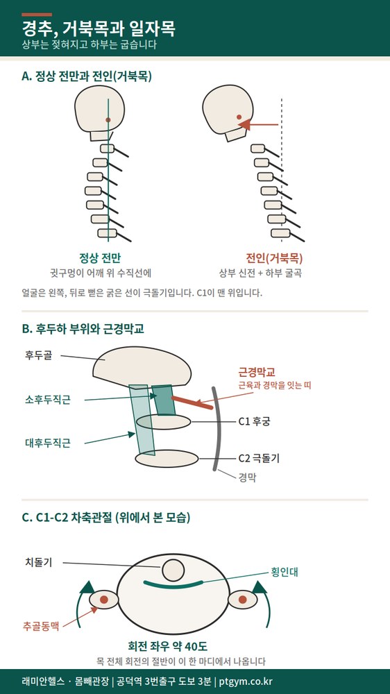 마포 교정운동 PT | 경추 정리 - 거북목은 굽는 게 아니라 앞으로 밀리는 것입니다 - 1 - 20260828001349