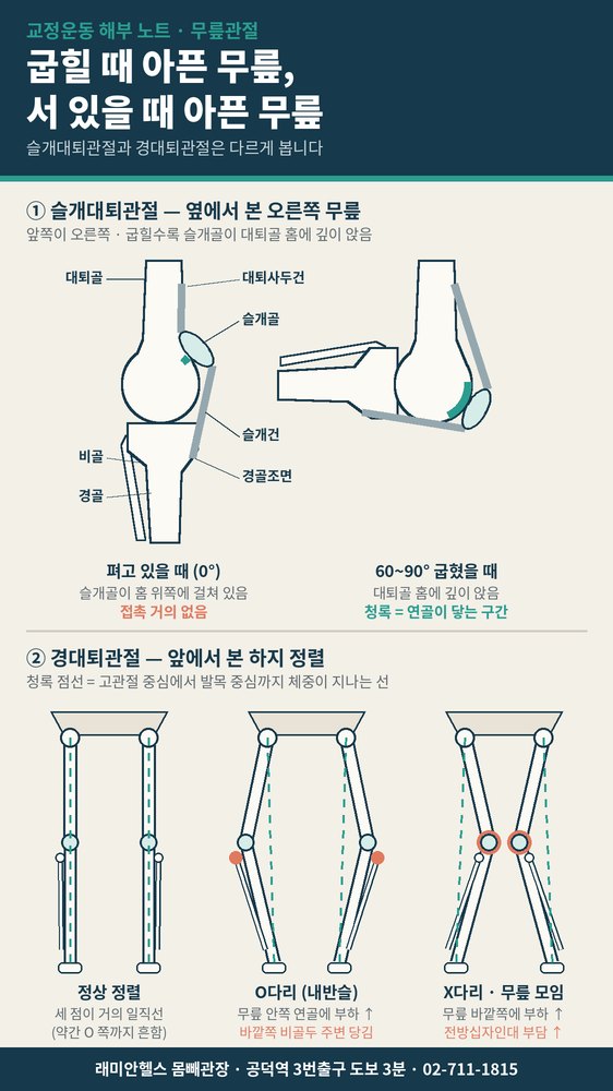 공덕동 교정운동 PT | 굽힐 때 아픈 무릎과 서 있을 때 아픈 무릎은 다릅니다 - 1 - 20260927180416