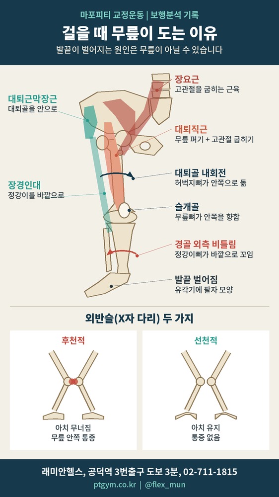 아현 교정운동 PT | 걸을 때 발끝이 벌어지고 무릎이 도는 이유, 보행분석으로 본 무릎 회전 - 2 - 20261011182120