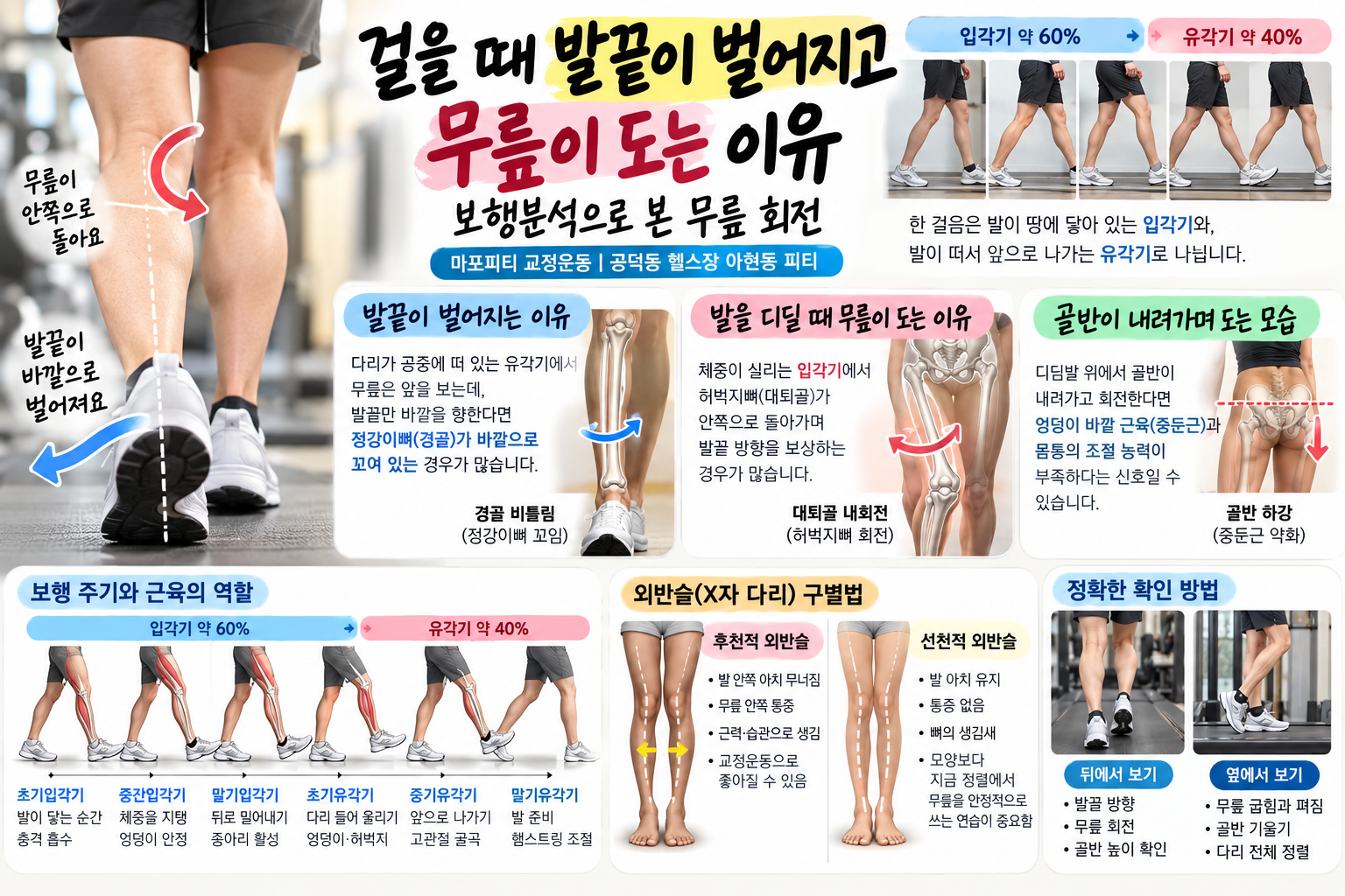 아현 교정운동 PT | 걸을 때 발끝이 벌어지고 무릎이 도는 이유, 보행분석으로 본 무릎 회전 - 1 - 20261011182120