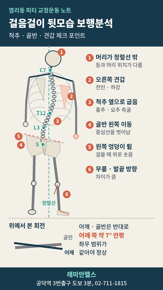 대흥 교정운동 PT | 걸음걸이 뒷모습으로 보는 척추와 골반 - 보행분석 체크 6곳 - 3 - 20261014002758