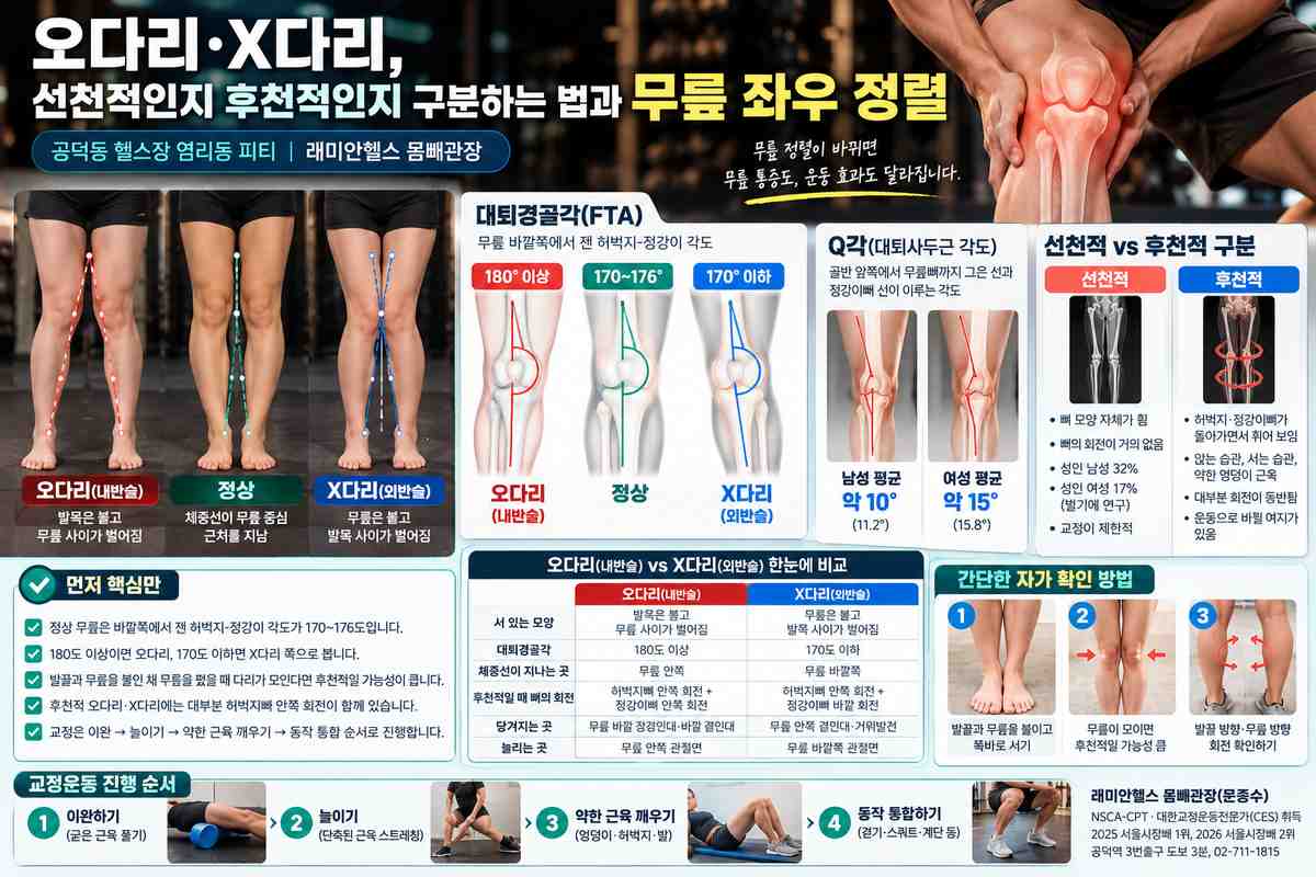 도화동 교정운동 PT | 오다리·X다리, 선천적인지 후천적인지 구분하는 법과 무릎 좌우 정렬 - 1 - 20261016002500