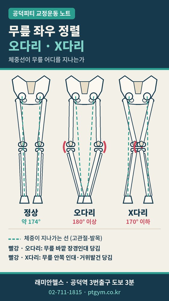 도화동 교정운동 PT | 오다리·X다리, 선천적인지 후천적인지 구분하는 법과 무릎 좌우 정렬 - 2 - 20261016002500