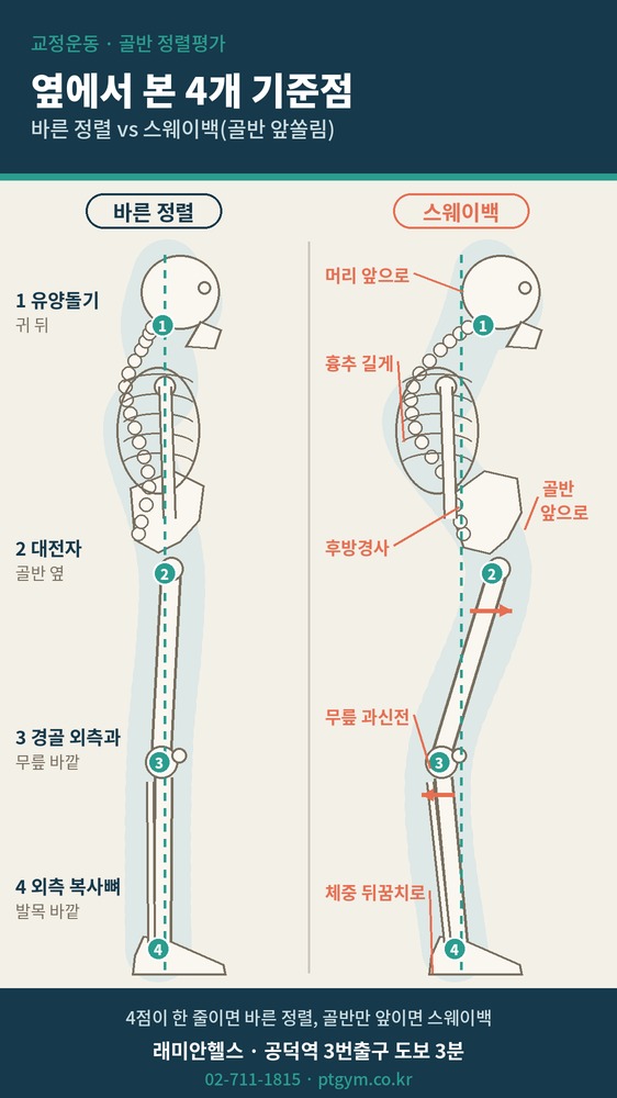 공덕동 교정운동 PT | 골반이 앞으로 빠진 스웨이백, 옆에서 본 4개 기준점으로 확인합니다 - 2 - 20261017002531