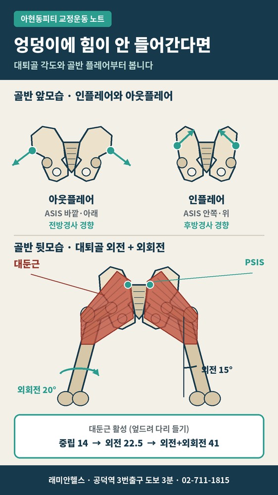 공덕동 교정운동 PT | 엉덩이에 힘이 안 들어가는 이유, 대퇴골 각도와 골반 인플레어·아웃플레어 - 염리동 피티 - 2 - 20261022003913