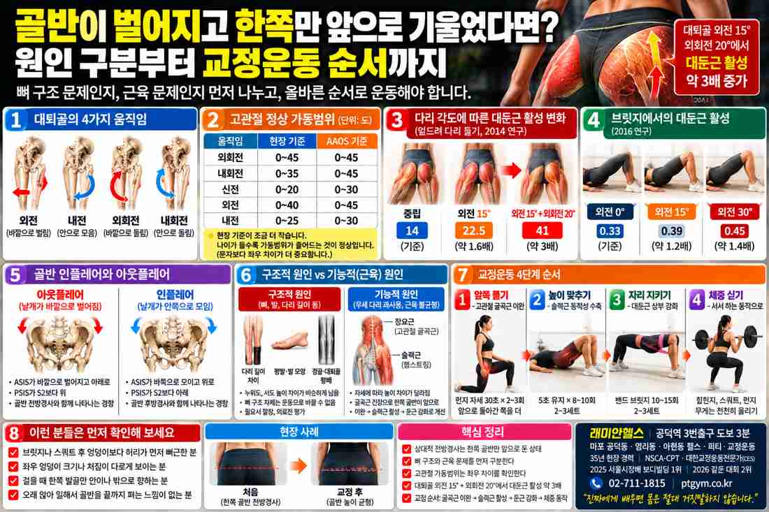 대흥동 교정운동 PT | 골반이 벌어지고 한쪽만 앞으로 기울었다면? 원인 구분부터 교정운동 순서까지 - 1 - 20261023001626