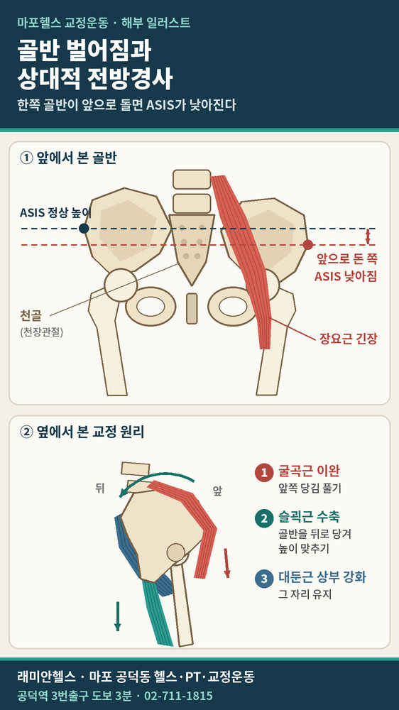 대흥동 교정운동 PT | 골반이 벌어지고 한쪽만 앞으로 기울었다면? 원인 구분부터 교정운동 순서까지 - 2 - 20261023001626