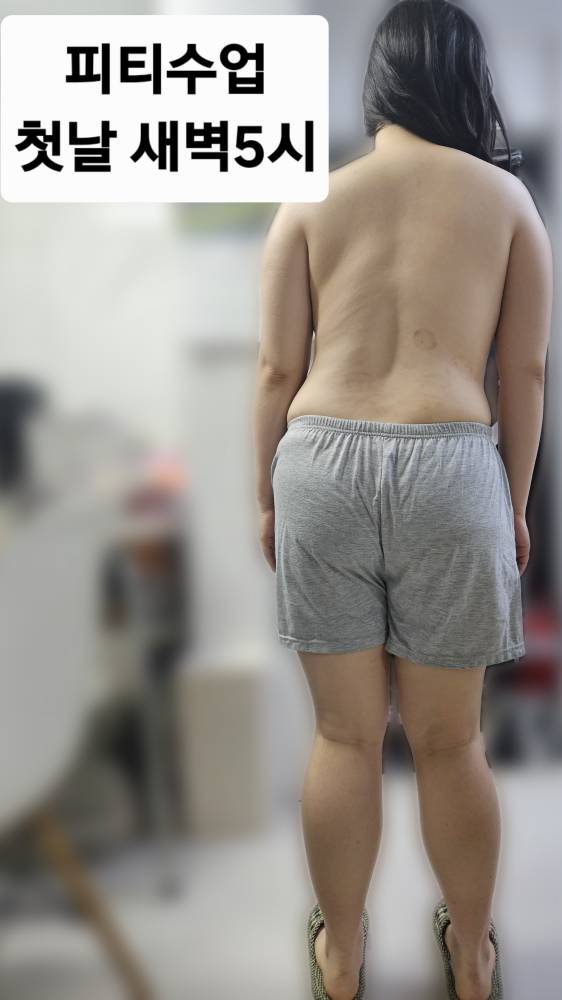 공덕 PT 헬스 | 디스크는 허리를 강화해서 쓰는 게 아닙니다 | 골반 정렬과 고관절 사용 정렬평가 기록 - 1 - 20260906212527