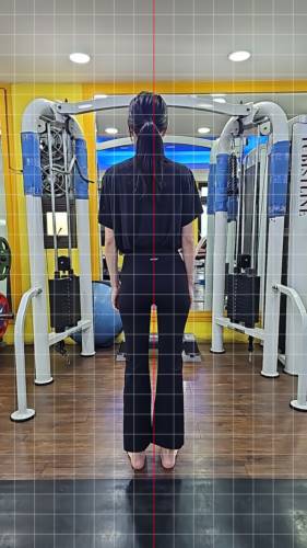 대흥 헬스 피티 40세 여성 정** 정렬평가 척추측만증 골반회전 익상견갑 대퇴골 내회전 - 1 - 20260505192717
