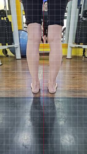 대흥 헬스 피티 40세 여성 정** 정렬평가 척추측만증 골반회전 익상견갑 대퇴골 내회전 - 14 - 20260505192717
