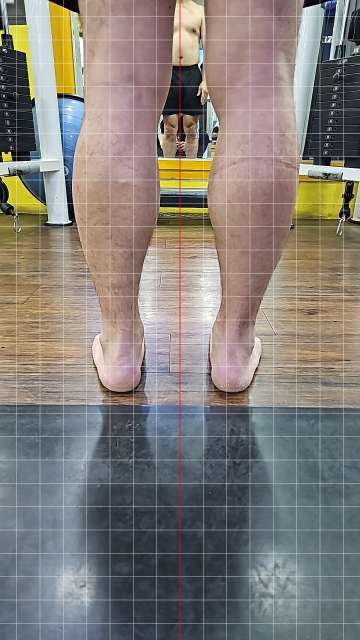 아현 헬스 피티 PT 48세 남성 한** 정렬평가 대퇴골 내회전 경골 벌어짐 견갑골 전인 - 10 - 20260525185503
